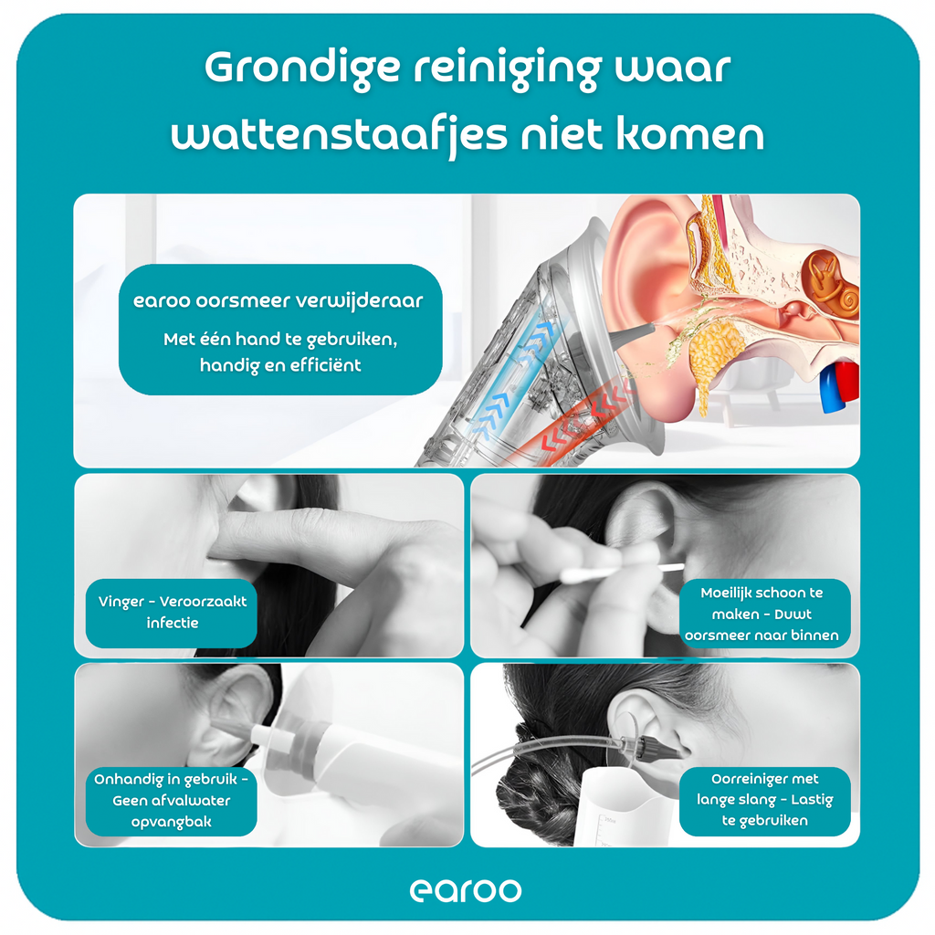 Earoo® Elektrische Oorsmeer Verwijderaar